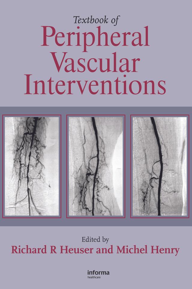 Textbook of Peripheral Vascular Interventions by Michel Henry, Richard R. Heuser
