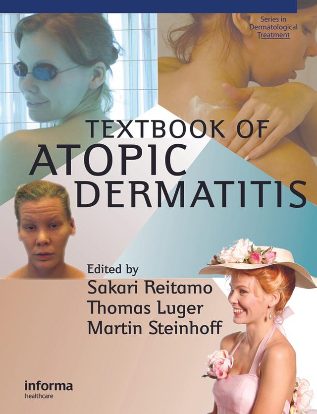 Textbook of Atopic Dermatitis by Martin Steinhoff, Sakari Reitamo, Thomas A. Luger