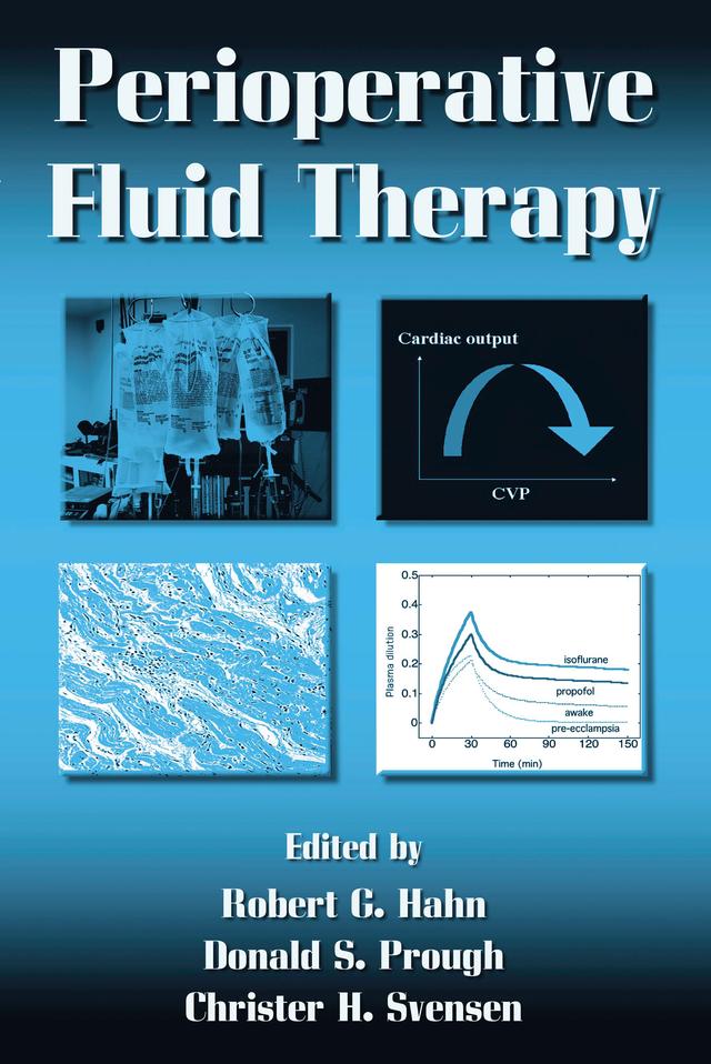 Perioperative Fluid Therapy by Christer H. Svensen, Donald S. Prough, Robert G. Hahn