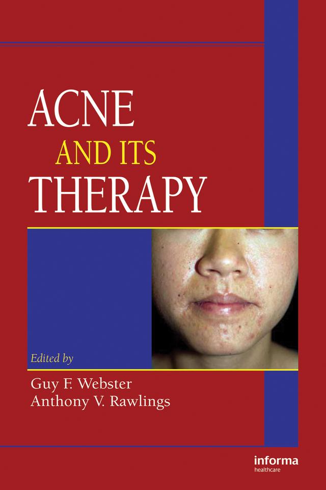 Acne and Its Therapy by Anthony V. Rawlings, Guy F. Webster