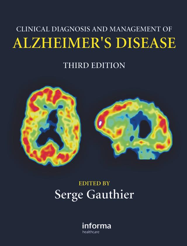 Clinical Diagnosis and Management of Alzheimer's Disease by Serge Gauthier