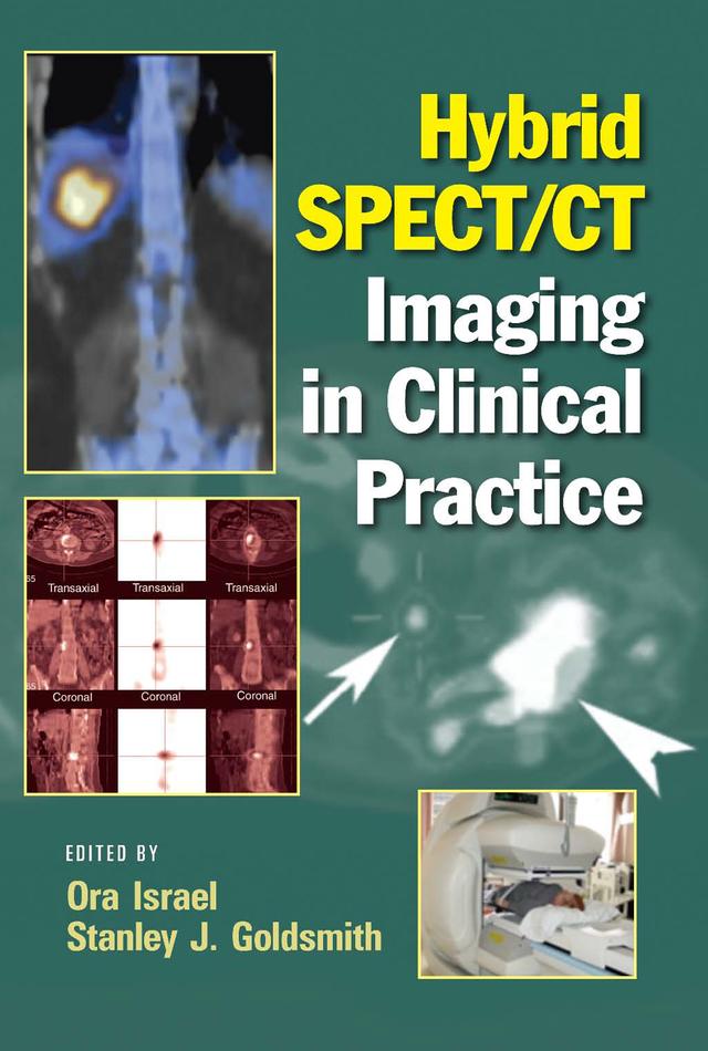 Hybrid SPECT/CT Imaging in Clinical Practice by Ora Israel, Stanley J. Goldsmith