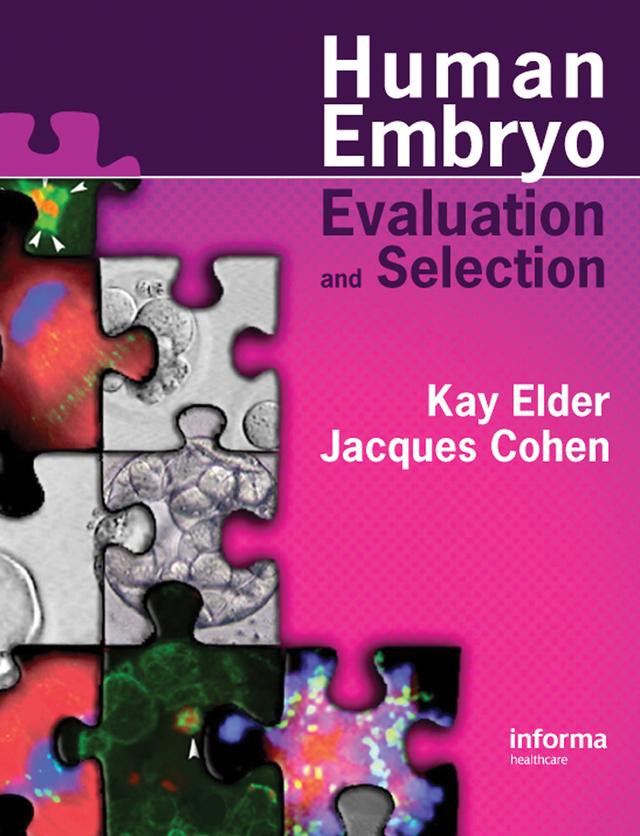 Human Preimplantation Embryo Selection by Jacques Cohen, Kay Elder