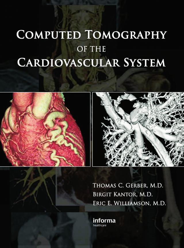 Computed Tomography of the Cardiovascular System by Birgit Kantor, Eric E. Williamson, Thomas C. Gerber