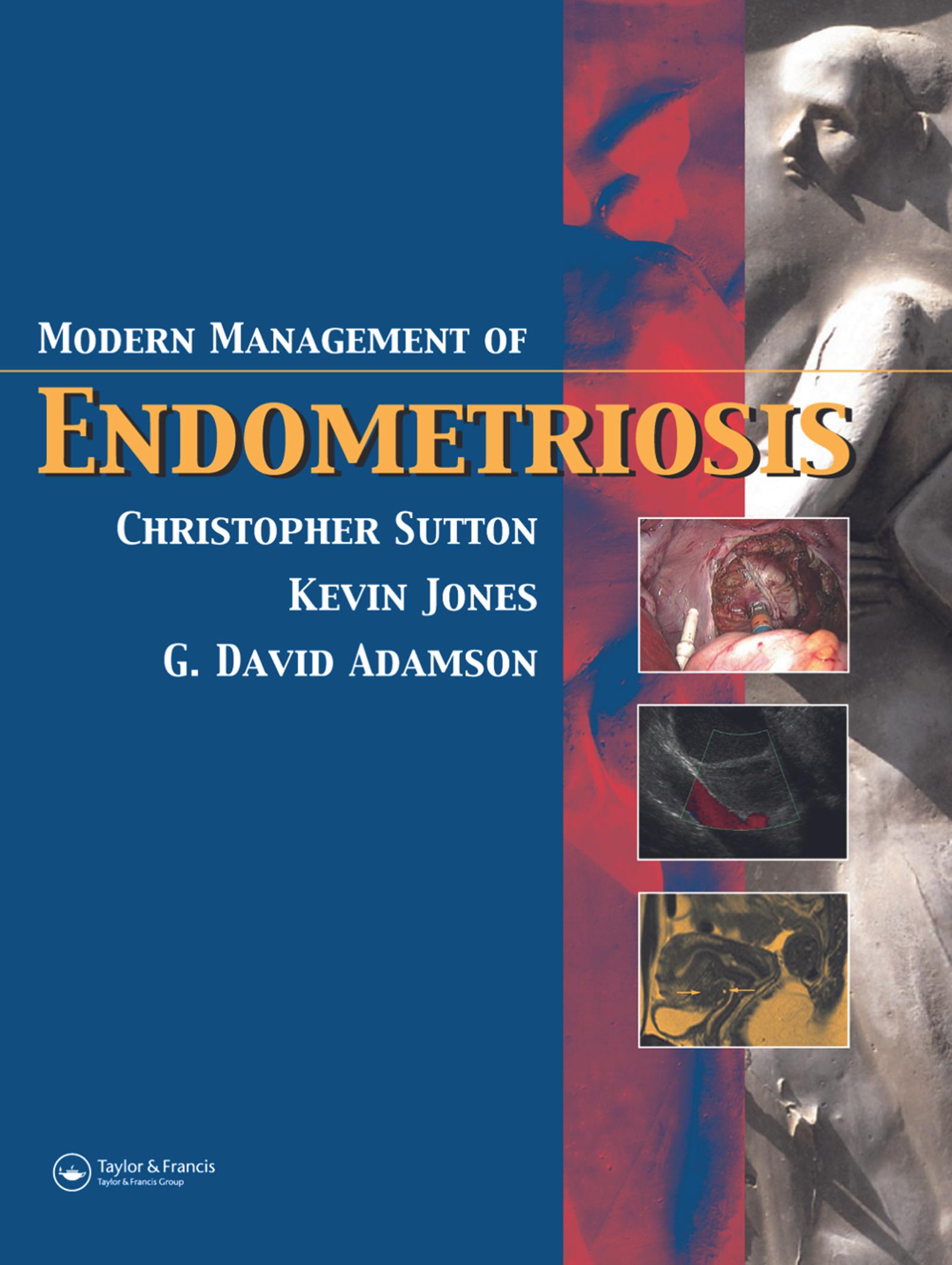 Modern Management of Endometriosis
