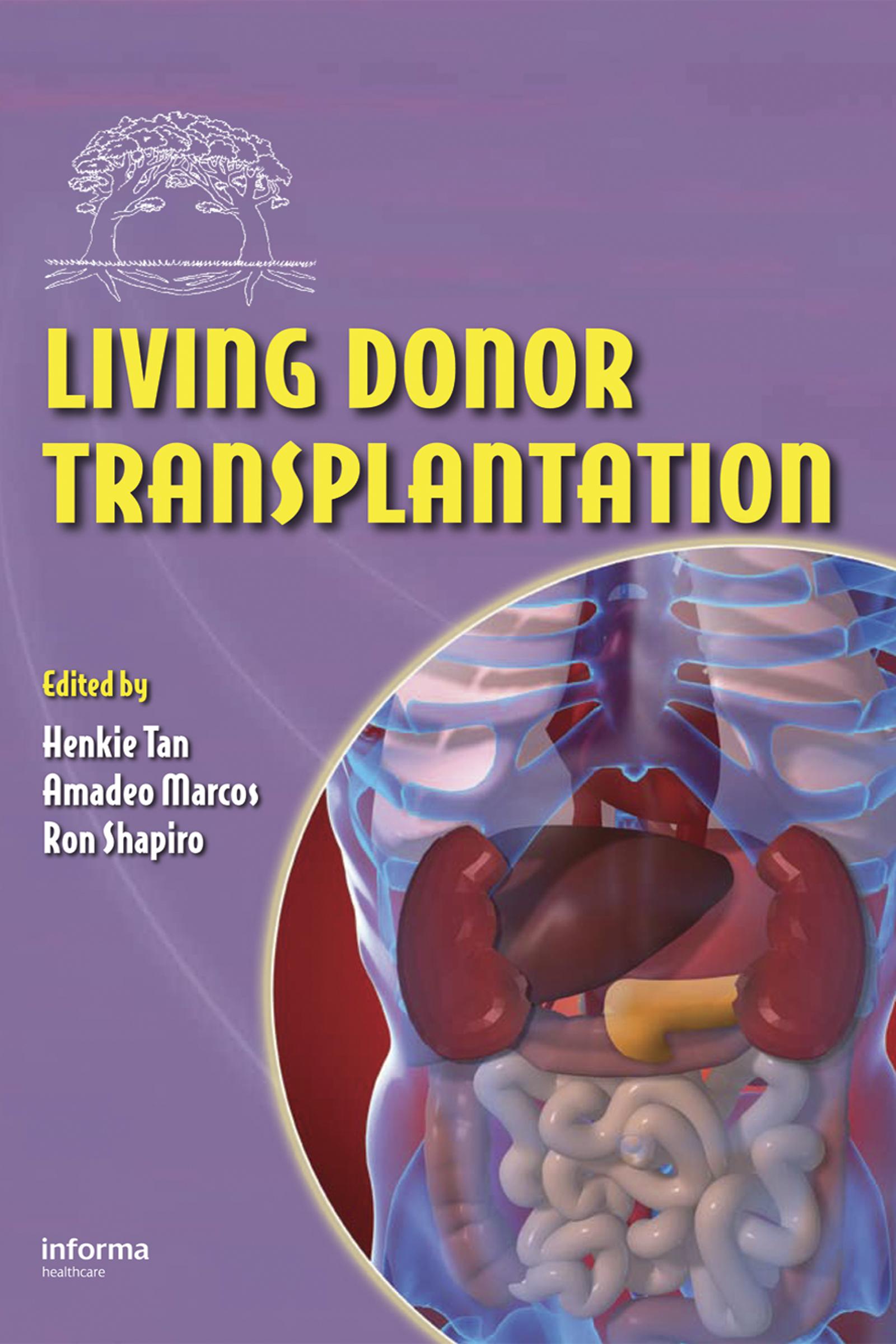 Living Donor Transplantation
