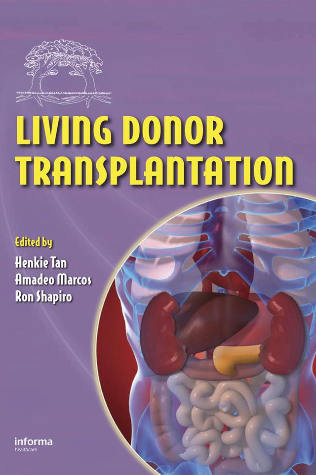Living Donor Transplantation by Amadeo Marcos, Henkie P. Tan, Ron Shapiro