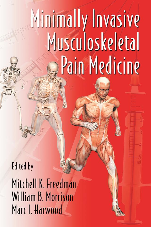 Minimally Invasive Musculoskeletal Pain Medicine by Marc I. Harwood, Mitchell Freedman, William B. Morrison MD
