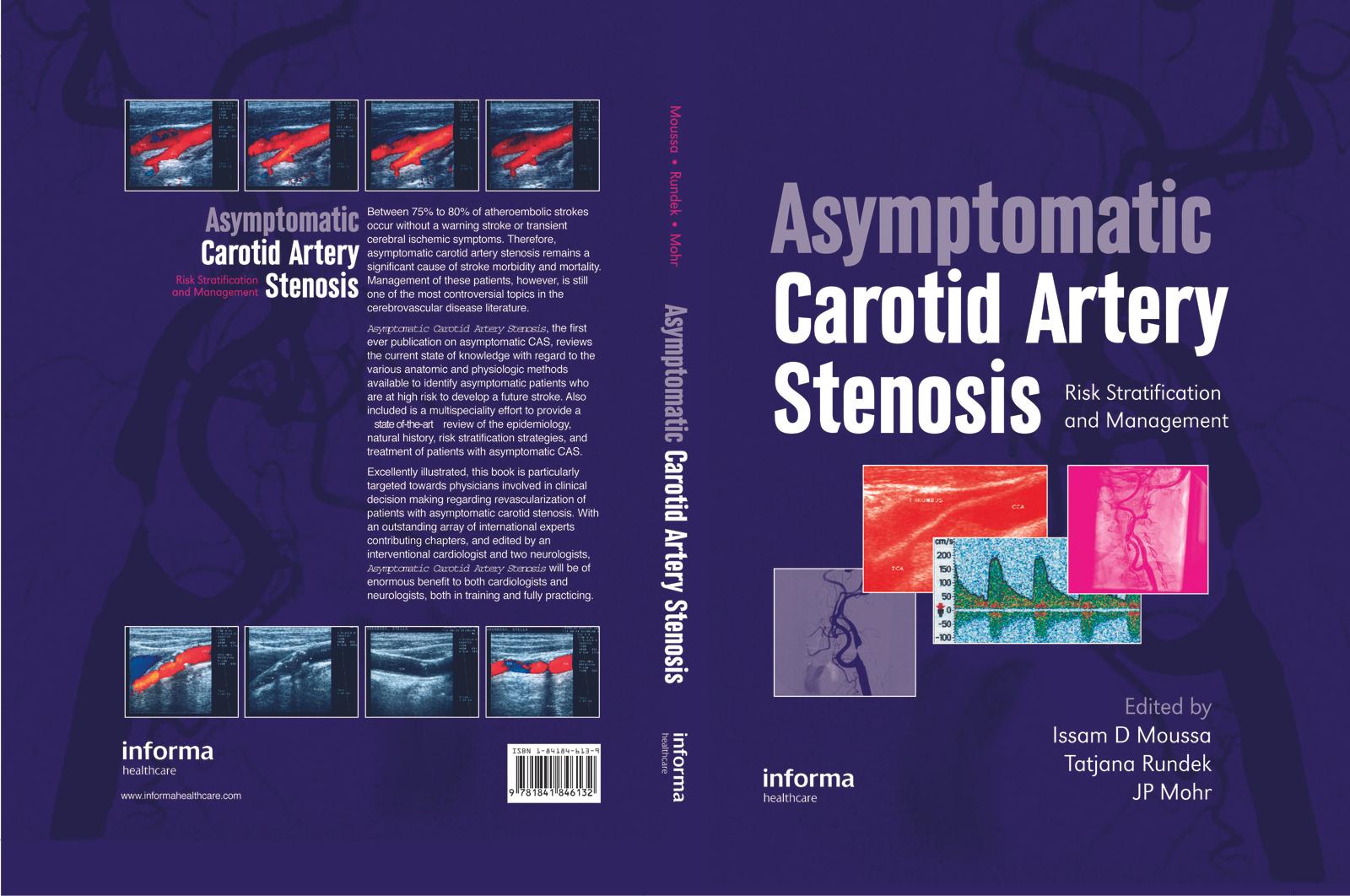 Asymptomatic Carotid Artery Stenosis