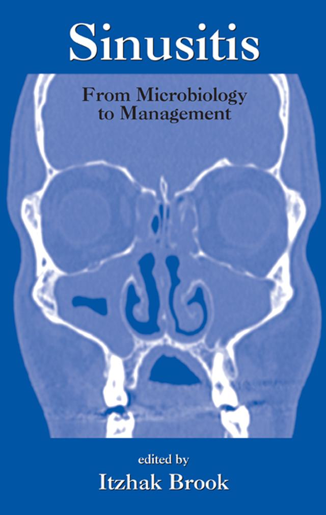 Sinusitis by Itzhak Brook