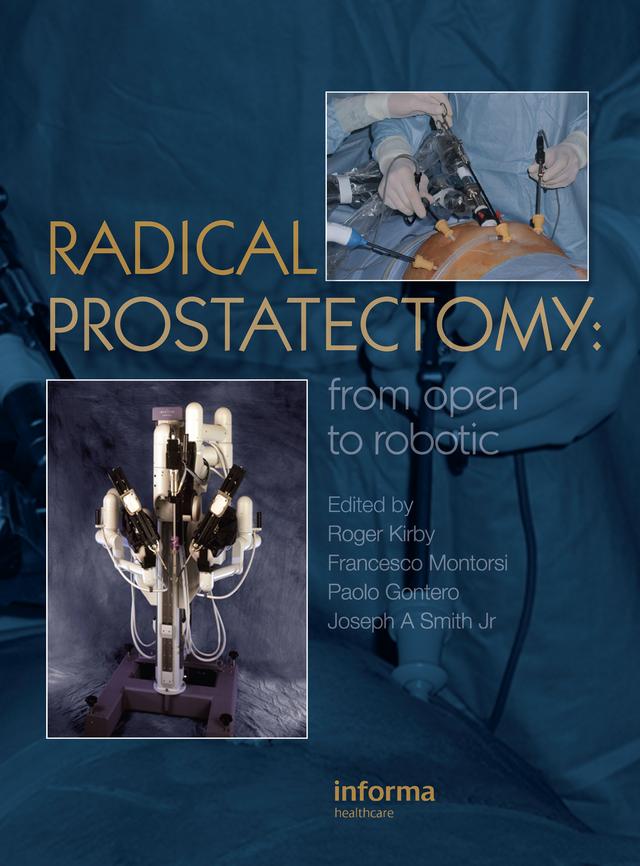 Radical Prostatectomy by Francesco Montorsi, Joseph A Smith, Paolo Gontero, Roger Kirby