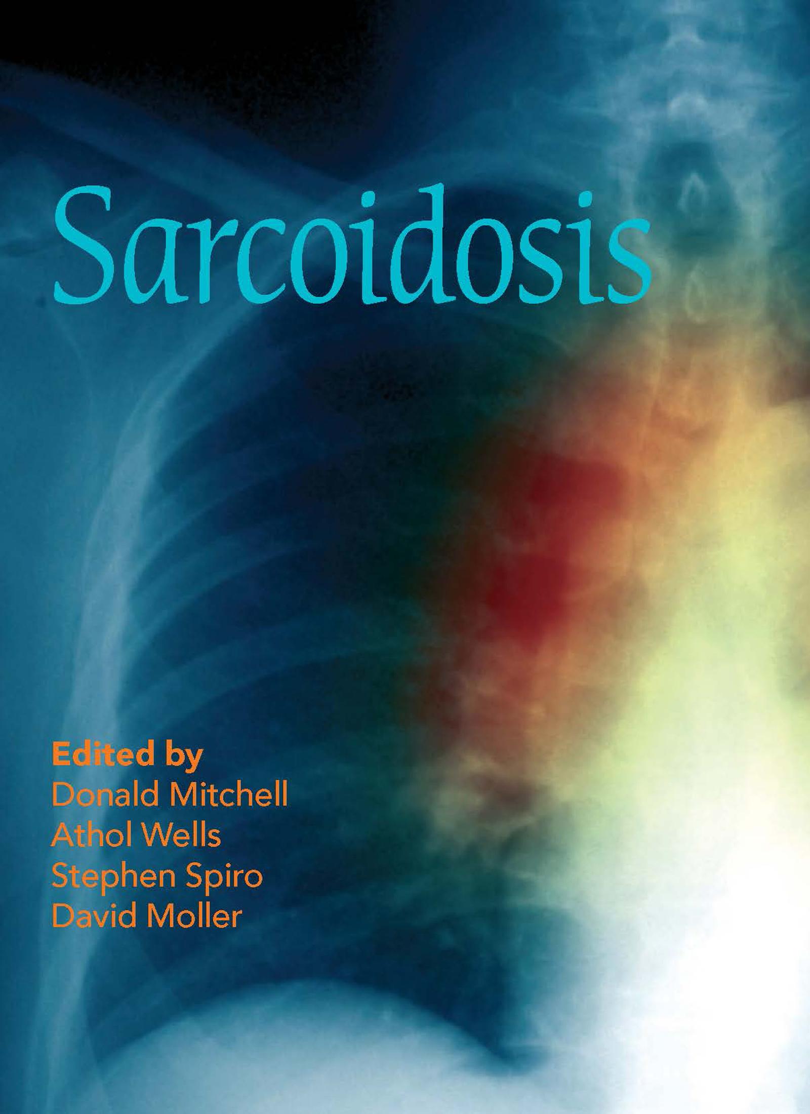 Sarcoidosis