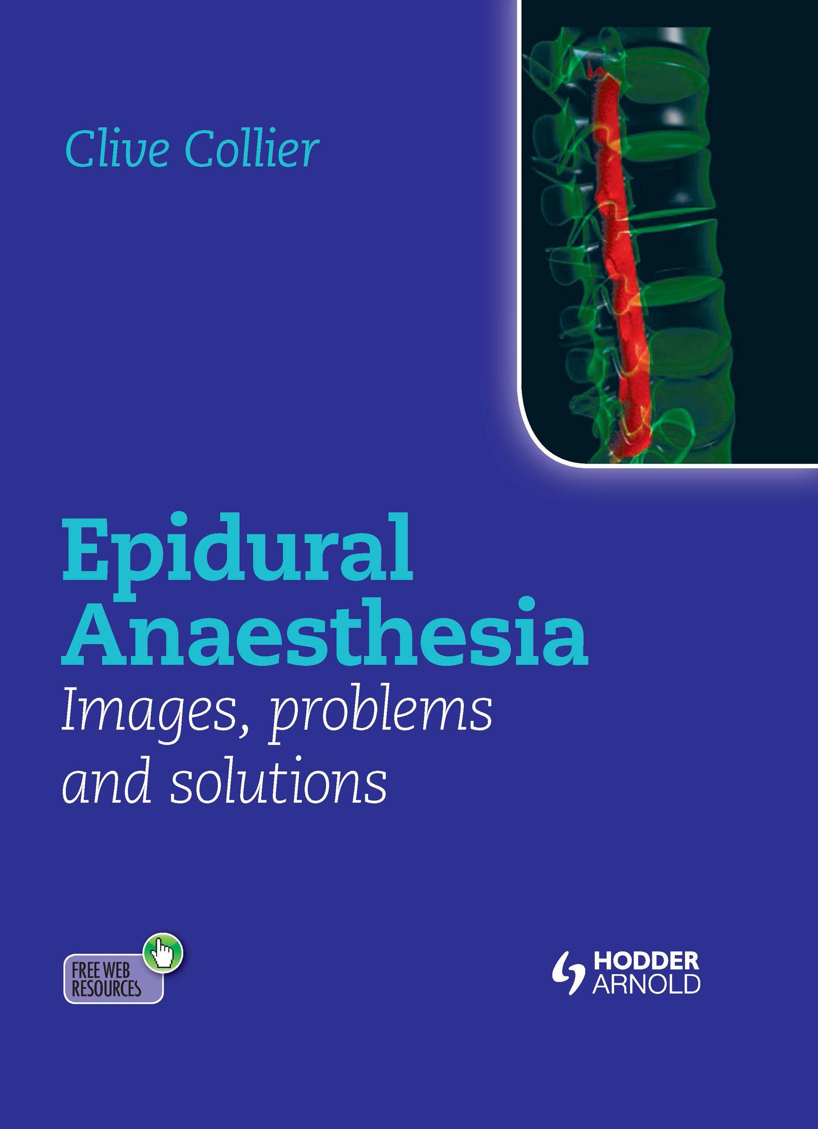 Epidural Anaesthesia: Images, Problems and Solutions