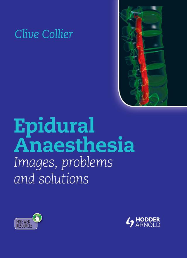 Epidural Anaesthesia: Images, Problems and Solutions by Clive Collier