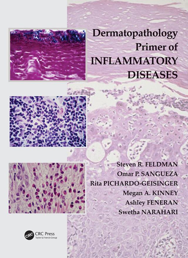 Dermatopathology Primer of Inflammatory Diseases by Ashley Feneran, Megan Kinney, Omar P. Sangueza, Rita Pichardo-Geisinger, Steven R. Feldman, Swetha Narahari