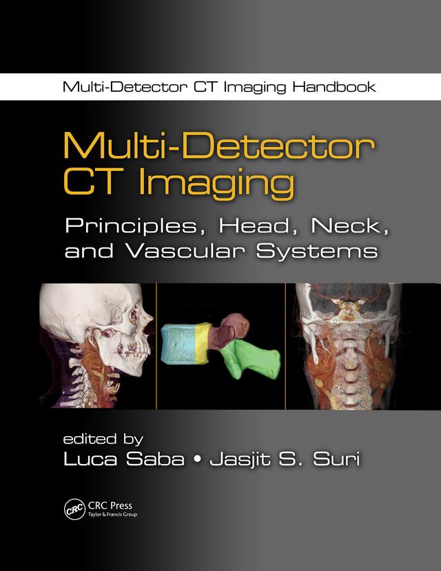 Multi-Detector CT Imaging by Jasjit S. Suri, Luca Saba