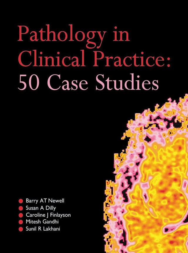 Pathology in Clinical Practice: 50 Case Studies by Barry AT Newell, Caroline Finlayson, Mitesh Gandhi, Sunil Lakhani, Susan Dilly