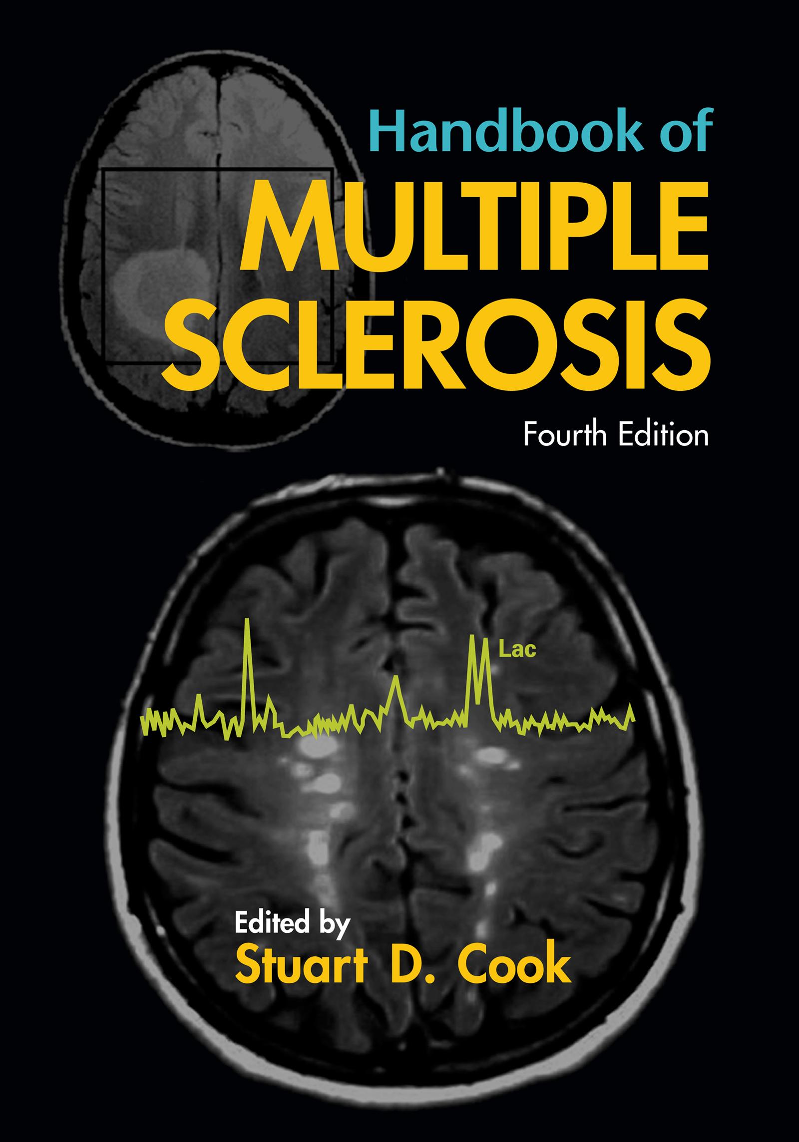 Handbook of Multiple Sclerosis