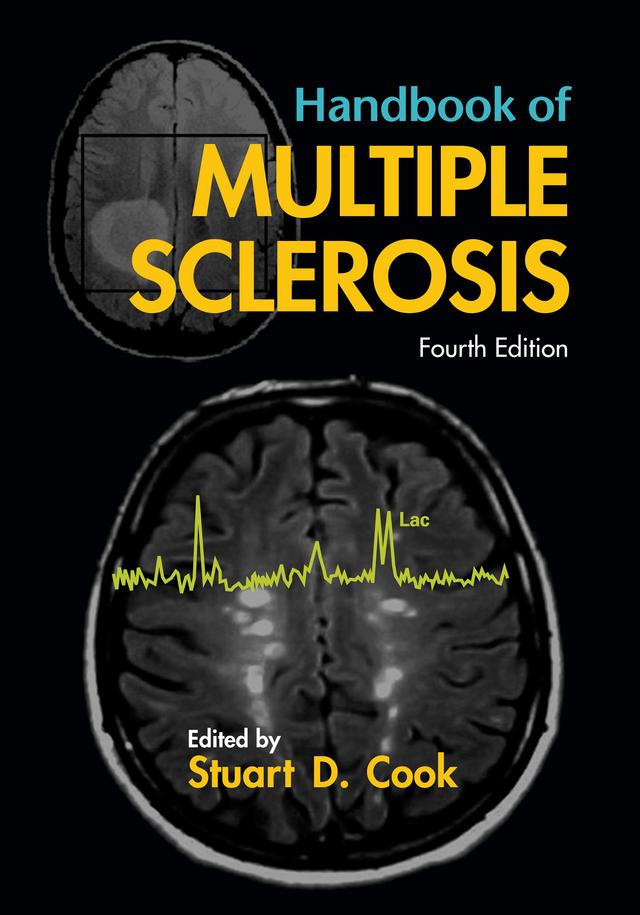 Handbook of Multiple Sclerosis by Stuart D. Cook