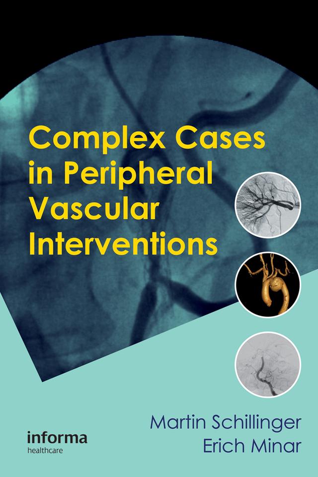 Complex Cases in Peripheral Vascular Interventions by Erich Minar, Martin Schillinger