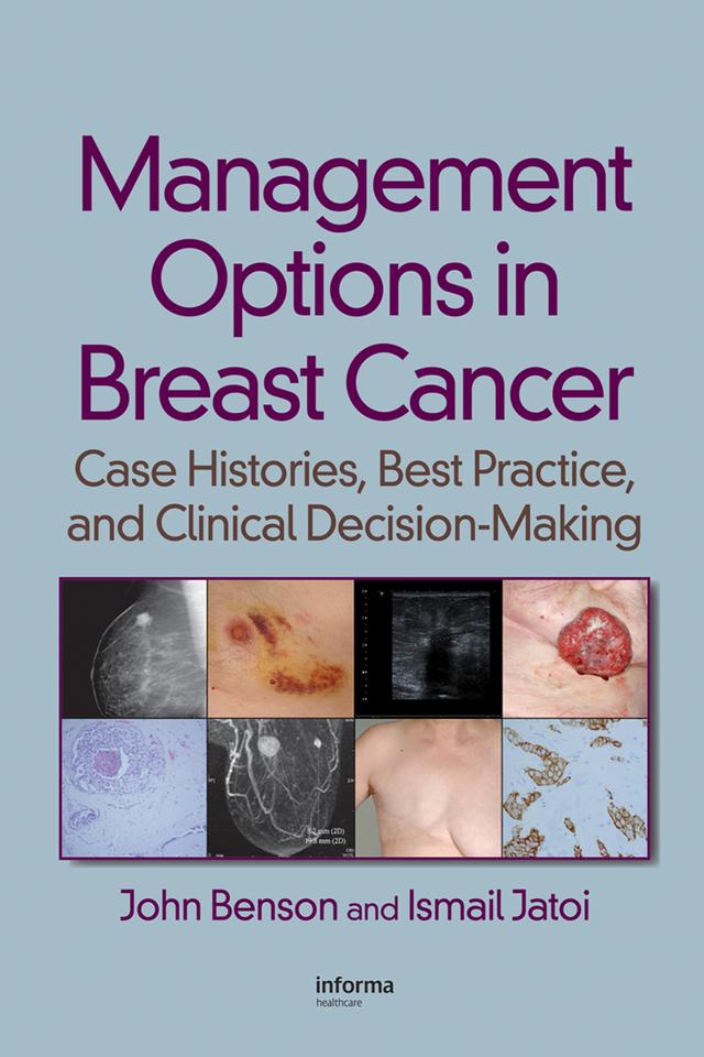 Management Options in Breast Cancer by Ismail Jatoi, John Benson