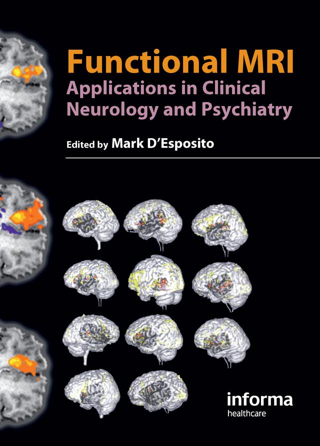 Functional MRI by Mark D'Esposito