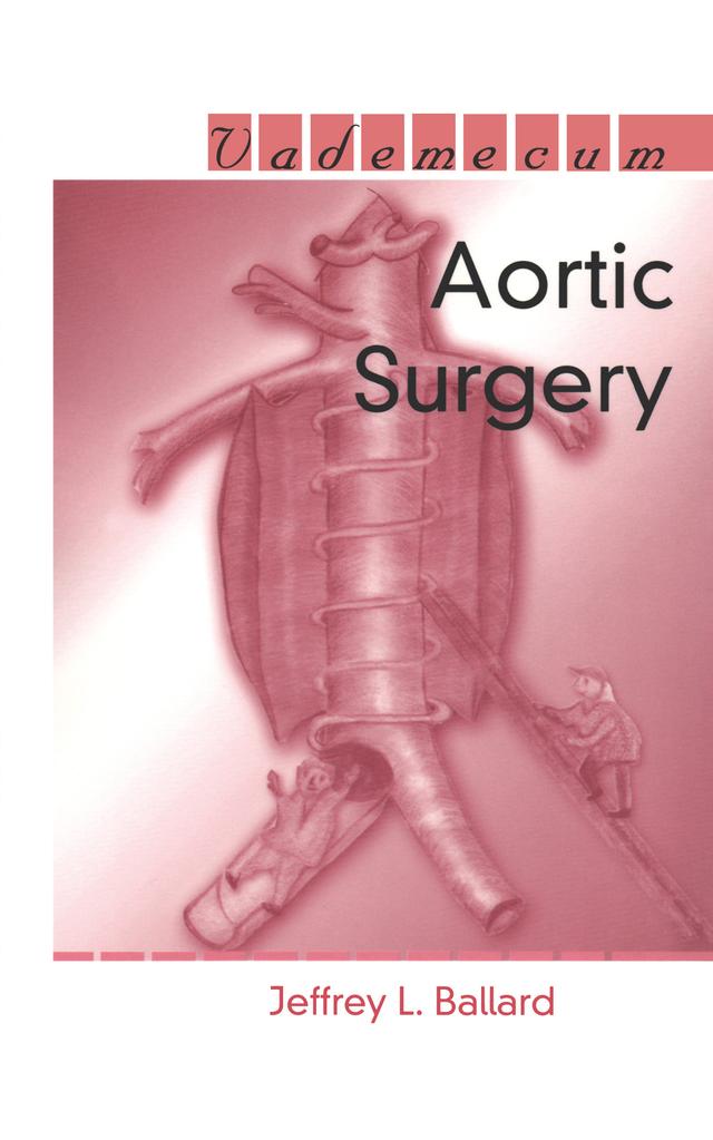 Aortic Surgery by Jeffrey L. Ballard