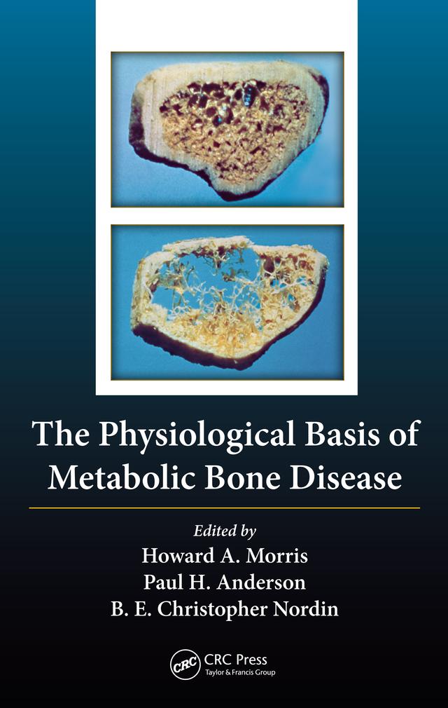 The Physiological Basis of Metabolic Bone Disease by Borje Edgar Christopher Nordin, Howard Arthur Morris, Paul Anderson