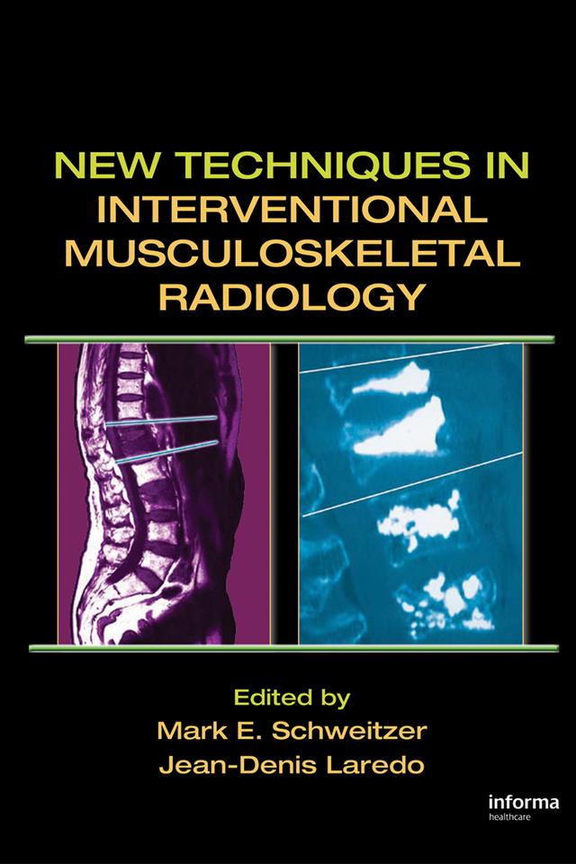 New Techniques in Interventional Musculoskeletal Radiology by Jean-Denis Laredo, Mark E. Schweitzer