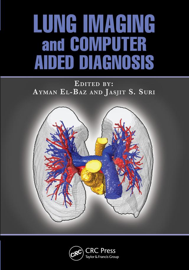 Lung Imaging and Computer Aided Diagnosis by Ayman El-Baz, Jasjit S. Suri