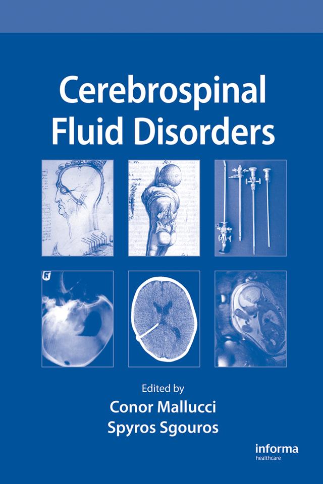 Cerebrospinal Fluid Disorders by Conor Mallucci, Spyros Sgouros
