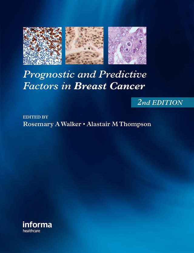 Prognostic and Predictive Factors in Breast Cancer by Alistair M. Thompson, Rosemary A. Walker