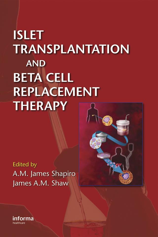 Islet Transplantation and Beta Cell Replacement Therapy by A. M. James Shapiro, James A. M. Shaw