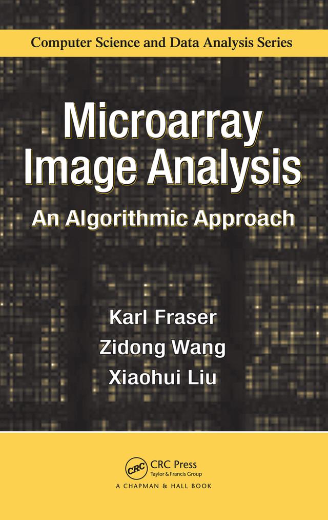 Microarray Image Analysis by Karl Fraser, Xiaohui Liu, Zidong Wang