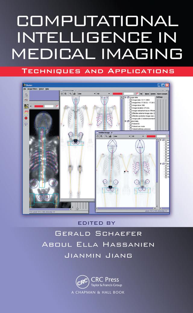 Computational Intelligence in Medical Imaging by A. Hassanien, G. Schaefer, J. Jiang