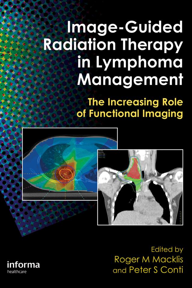 Image-Guided Radiation Therapy in Lymphoma Management by Peter S. Conti, Roger M. Macklis