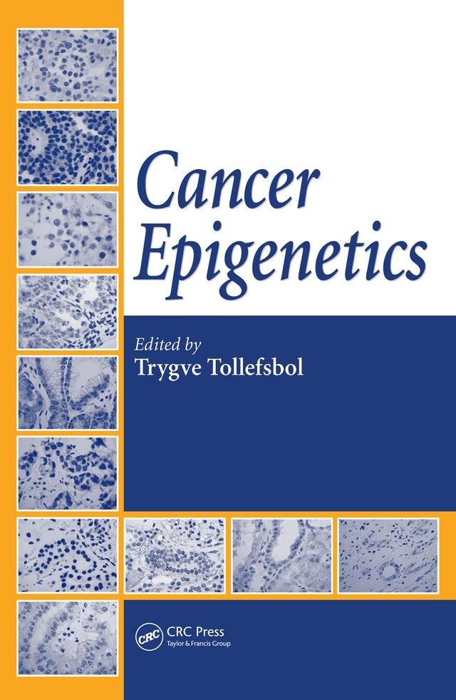Cancer Epigenetics by Trygve Tollefsbol