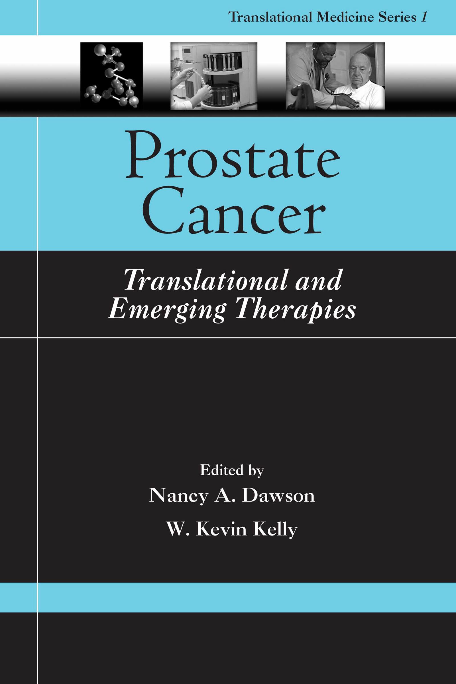 Prostate Cancer