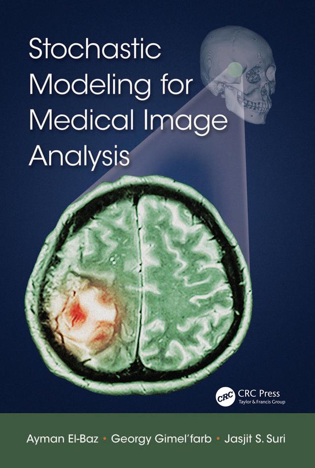 Stochastic Modeling for Medical Image Analysis by Ayman El-Baz, Georgy Gimel’farb, Jasjit S. Suri