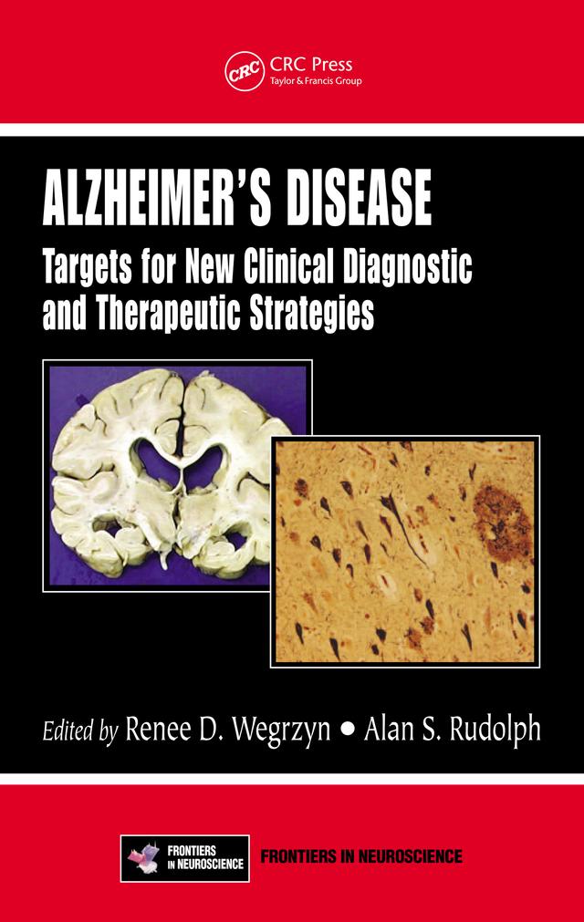 Alzheimer's Disease by Alan S. Rudolph, Renee D. Wegrzyn