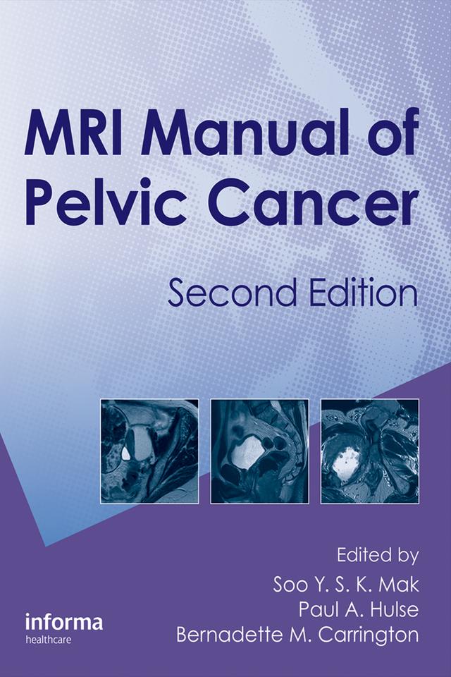 MRI Manual of Pelvic Cancer by B. M. Carrington, Paul A. Hulse, Soo Mak