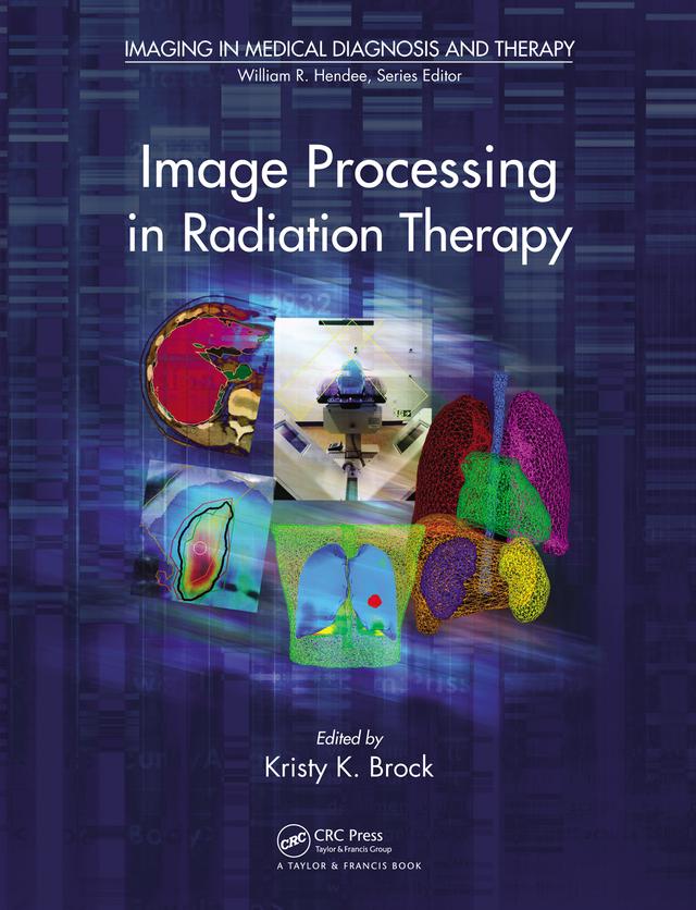 Image Processing in Radiation Therapy by Kristy K. Brock