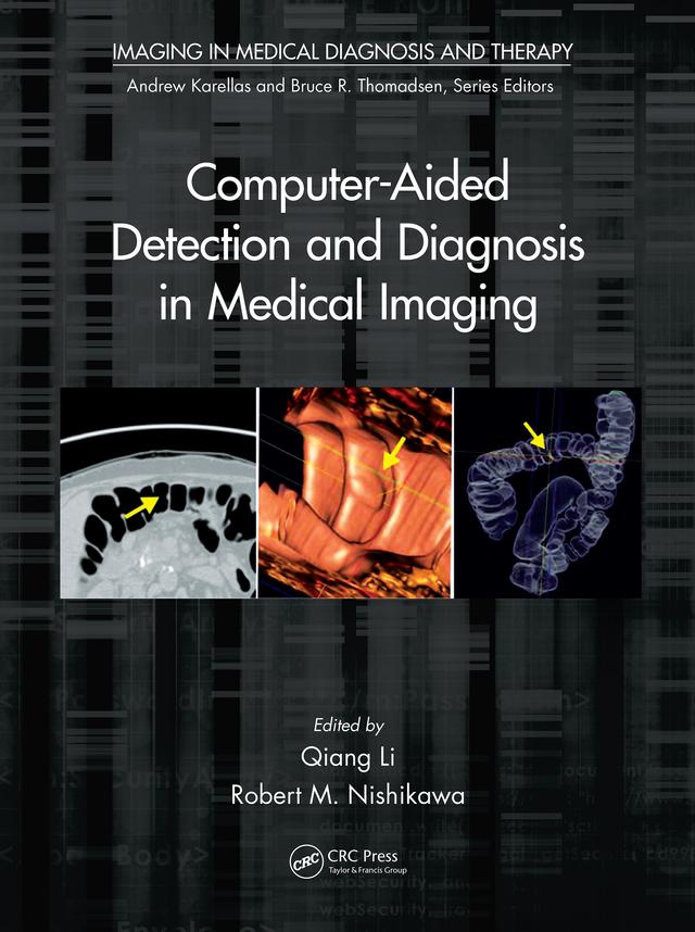 Computer-Aided Detection and Diagnosis in Medical Imaging by Qiang Li, Robert M. Nishikawa