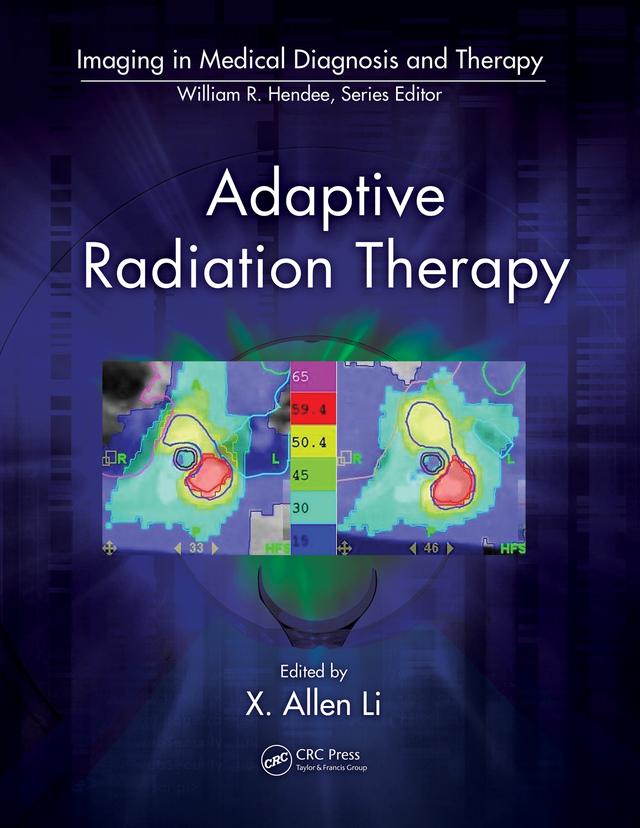 Adaptive Radiation Therapy by X. Allen Li