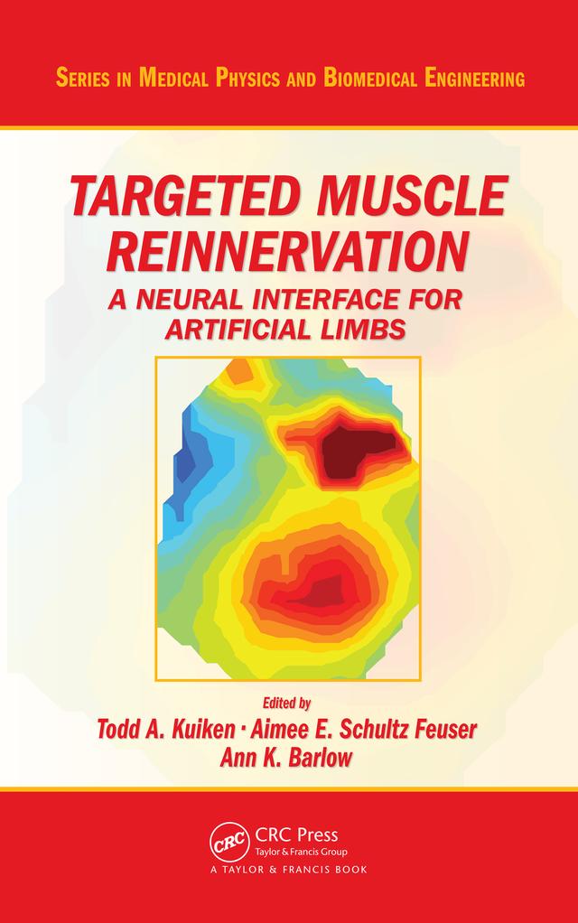 Targeted Muscle Reinnervation by Aimee E. Schultz Feuser, Ann K. Barlow, Todd A. Kuiken