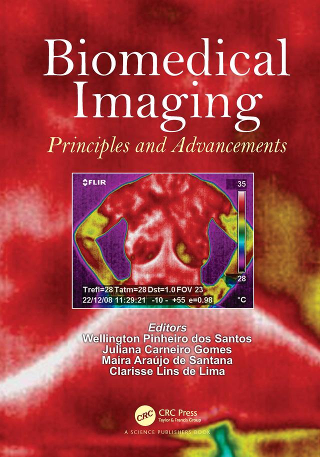 Biomedical Imaging by Clarisse Lins de Lima, Juliana Carneiro Gomes, Maíra Araújo de Santana, Wellington Pinheiro dos Santos