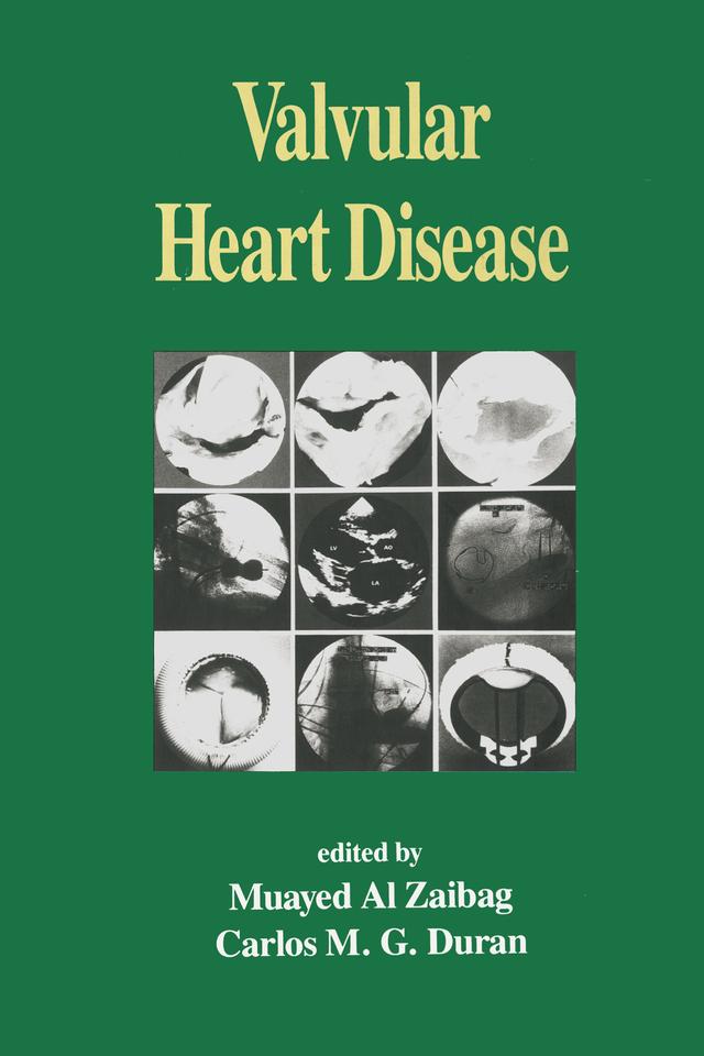 Valvular Heart Disease by Carlos M. G. Duran, Muayed AI Zaibag