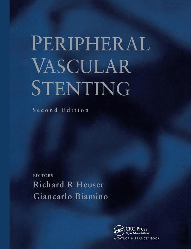 Peripheral Vascular Stenting, Second Edition by Giancarlo Biamino, Richard R. Heuser