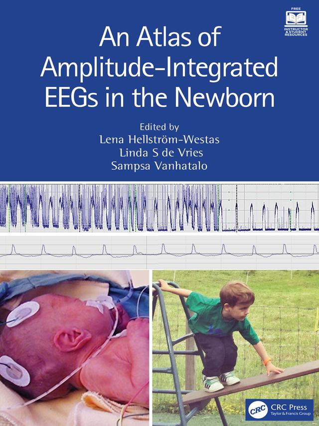 An Atlas of Amplitude-Integrated EEGs in the Newborn by Lena Hellström-Westas, Linda S de Vries, Sampsa Vanhatalo