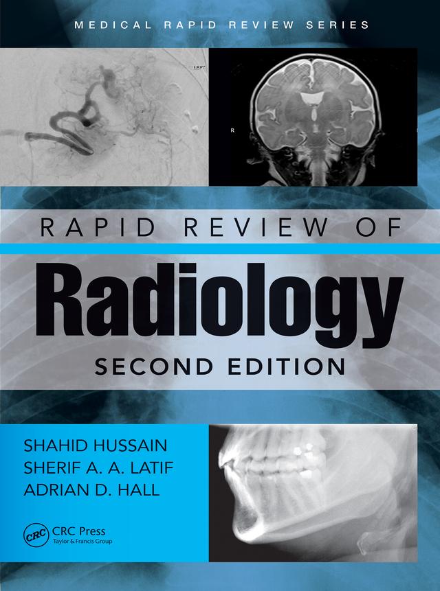 Rapid Review of Radiology by Adrian David Hall, Shahid Hussain, Sherif Aaron Abdel Latif
